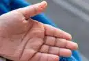 arrugan