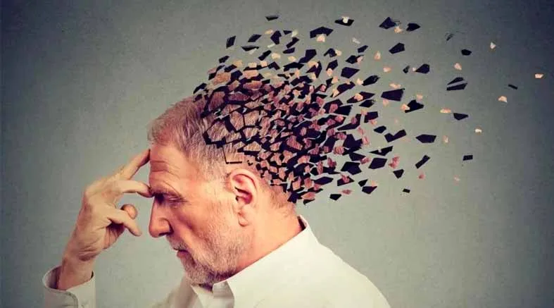 Alzheimer