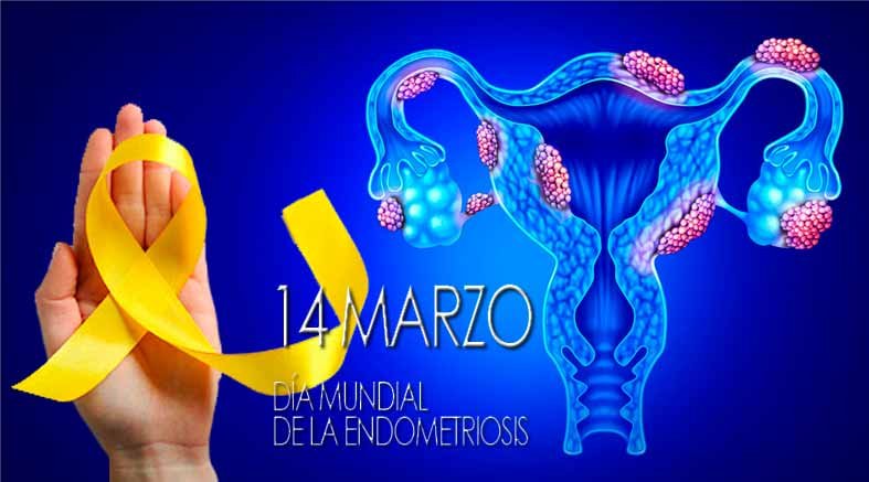 14 de marzo Día Mundial de la Endometriosis